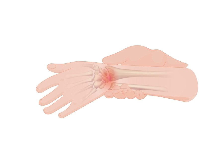 Hand- en polspijn | Bodycare Fysiotherapie en Leefstijl