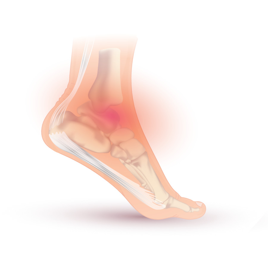 enkel en voet pijnklachten | Doornbos Fysio